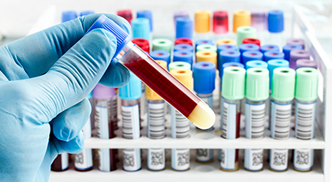 Blood sample 2